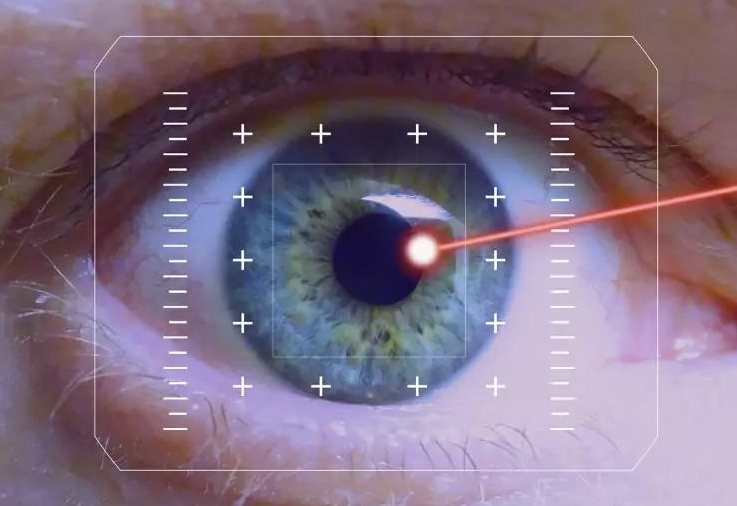 LASIK: Solusi Modern untuk Penglihatan Lebih Tajam